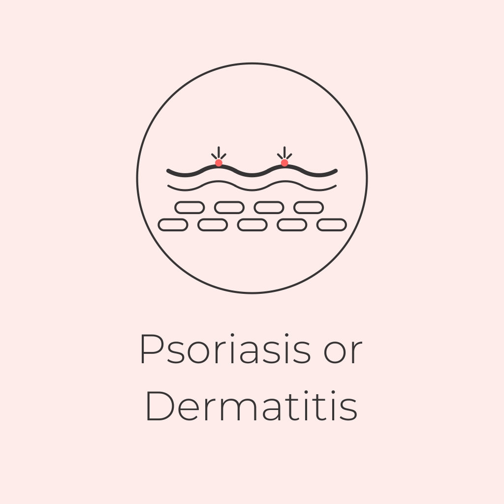Is it Psoriasis or Dermatitis?