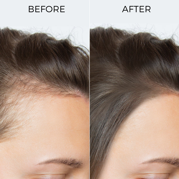 100% Rosemary Essential Oil for Hair Growth