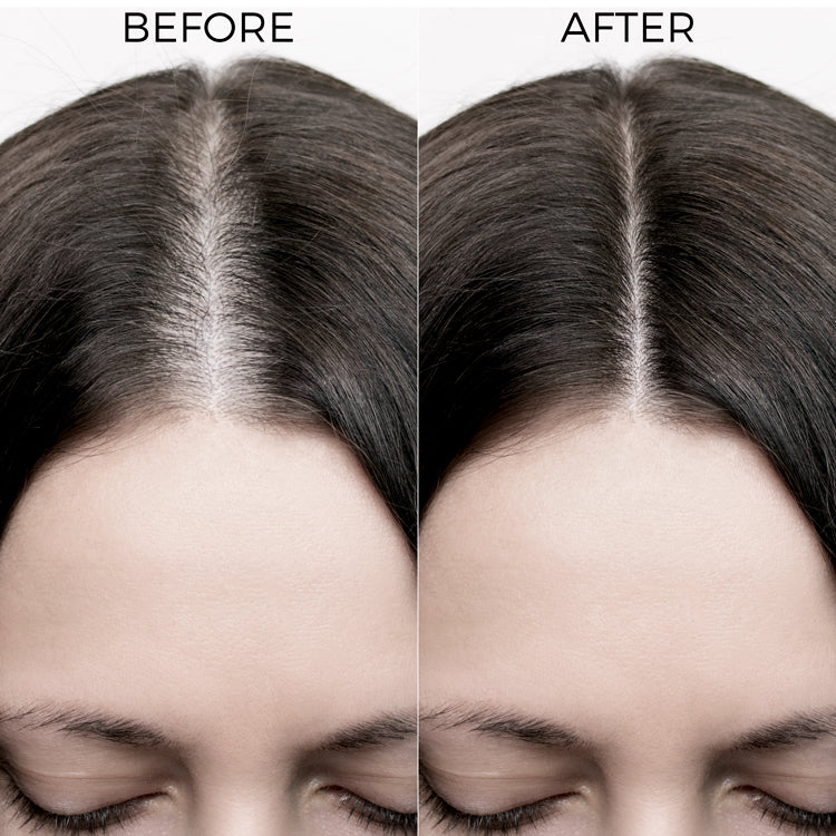 before and after image of using Brillare Rosemary Oil Shots.