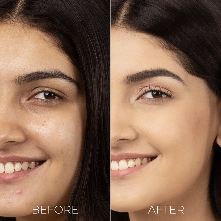 Salicylic Acid Liquid Moisturiser for oily, acne prone skin