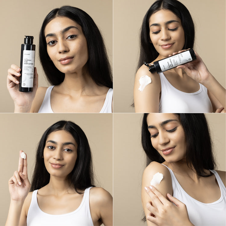 1% Salicylic Acid Body Lotion for Acne-Prone Skin