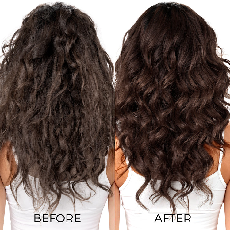 Complete Dandruff Control kit