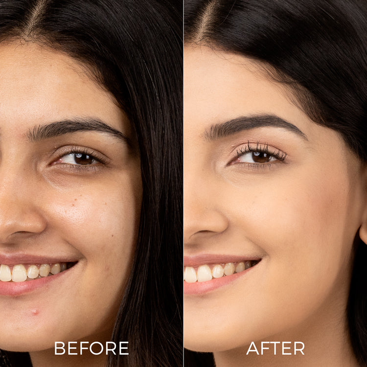 before and after images of using Brillare Vitamin C Face Serum.