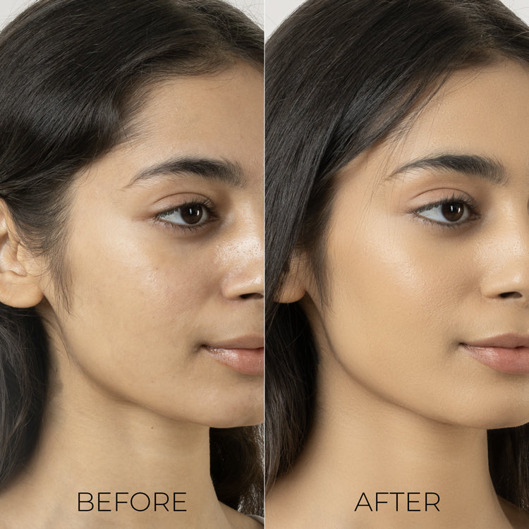 Oil Away Serum Mist For Acne Prone Skin