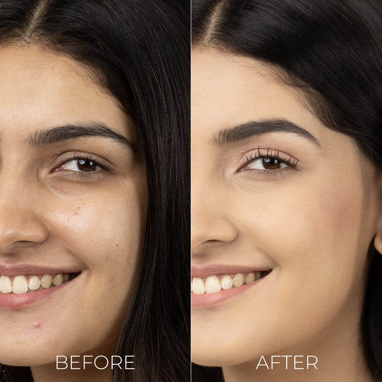 Skin Brightening Serum Mist For Pigmented Skin