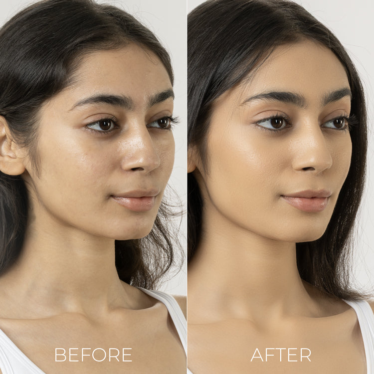 2% Salicylic and 3% Lactic Acid Face Wash for acne prone skin