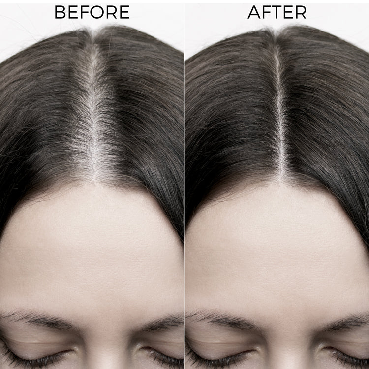 Onion & Bakuchiol Oil Shots For Hair Fall Reduction