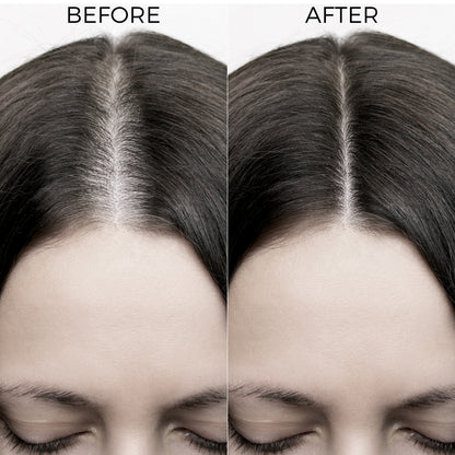 Mini Hair Fall Control mask To Reduce Seasonal Hair Fall (20ml)