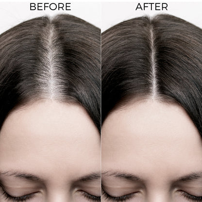 before and after image of using Brillare Rosemary Oil Shots.